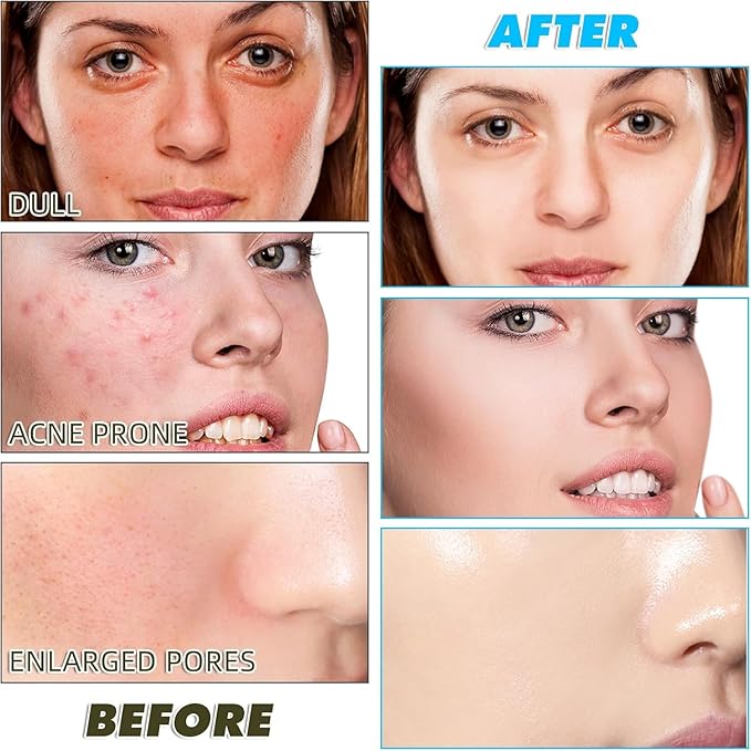 Kojic Acid Turmeric Cleansing Pads